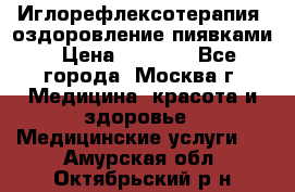 Иглорефлексотерапия, оздоровление пиявками › Цена ­ 3 000 - Все города, Москва г. Медицина, красота и здоровье » Медицинские услуги   . Амурская обл.,Октябрьский р-н